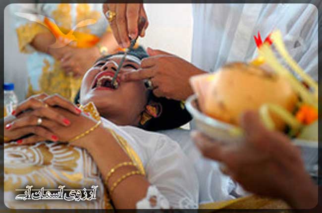 پر کردن دندان ها، رسمی عجیب در هندوستان